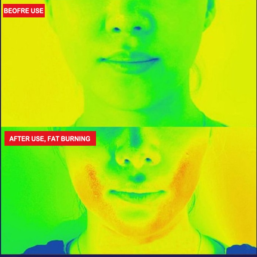 The Face Slimming Strap™